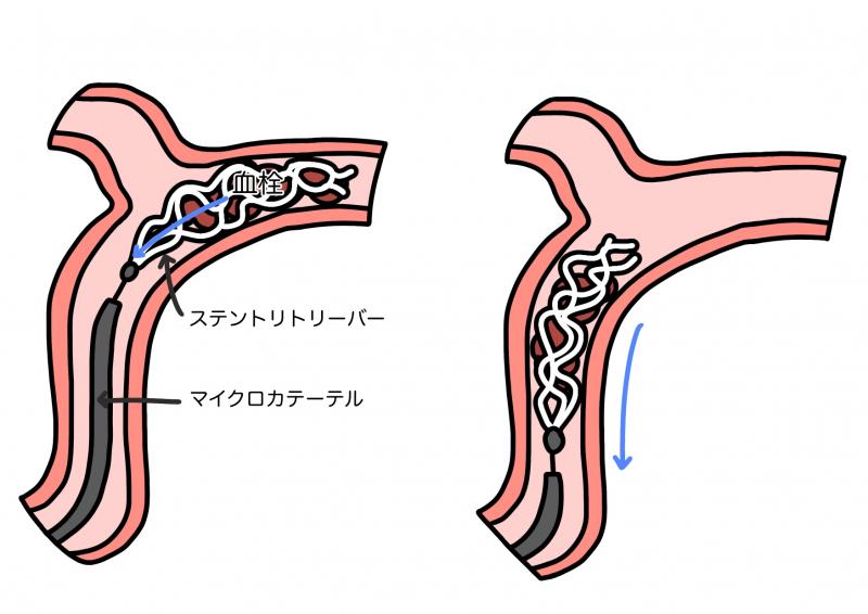 kessenkaisyuu