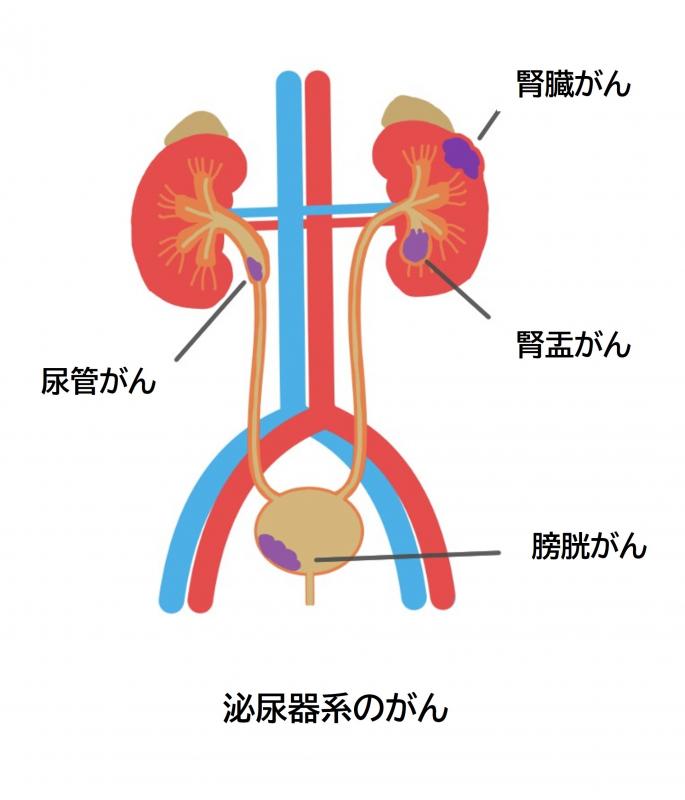 hinyoukigan1
