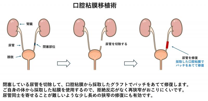 koukuunenmakuisyoku1
