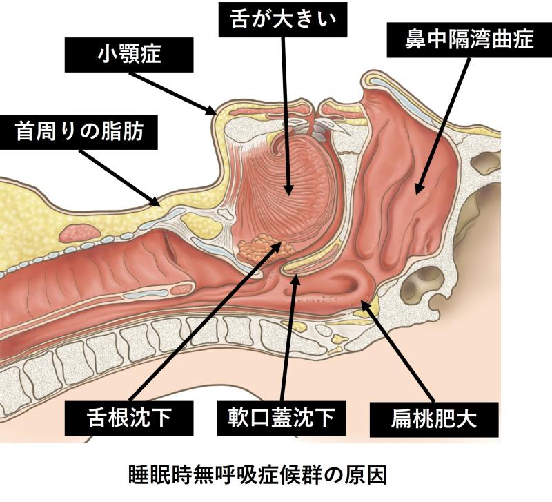mukokyuugenin