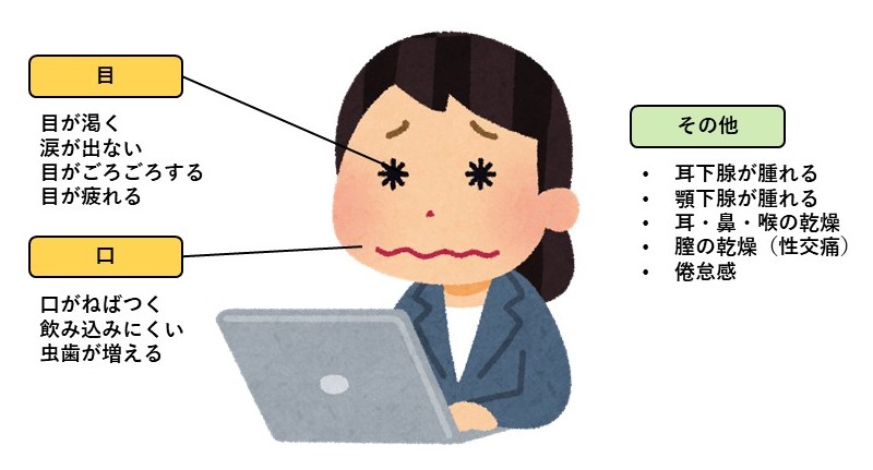 シェーグレン症候群の部位ごとの症状