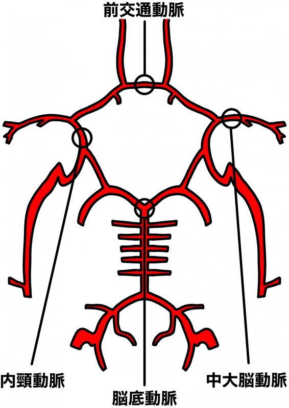 doumyakuryuukouhatu