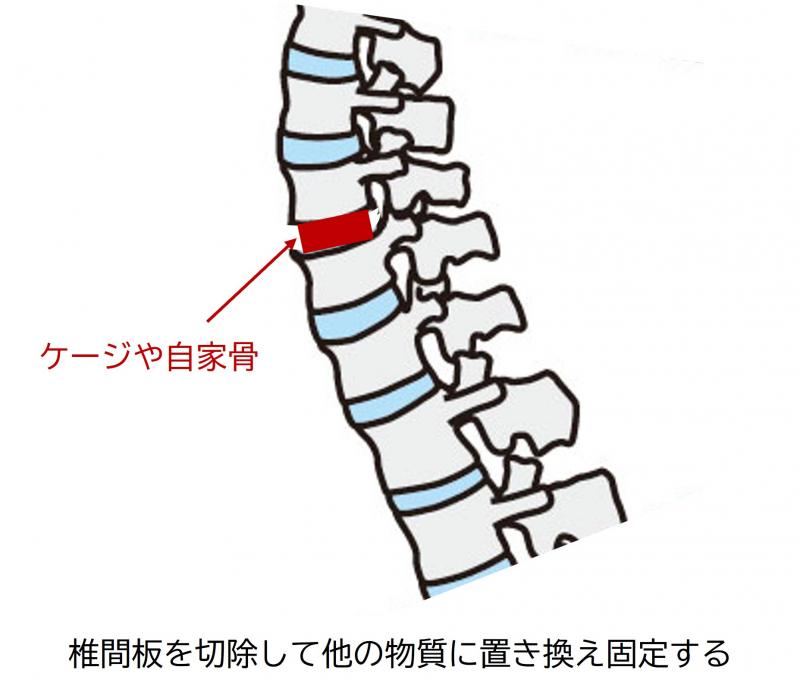 keibukotei