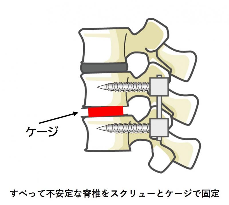 suberisyoukotei