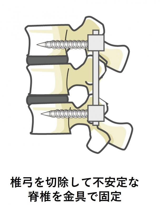 tuikyuukotei