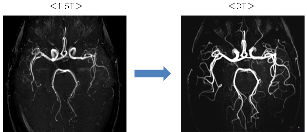 1.5TMR装置での写真と3TMR装置での写真比較