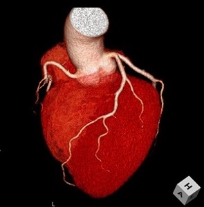 心臓の3D画像
