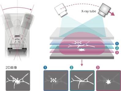 2Dマンモグラフィと3Dマンモグラフィの撮影方法及び画像の見え方の模式図