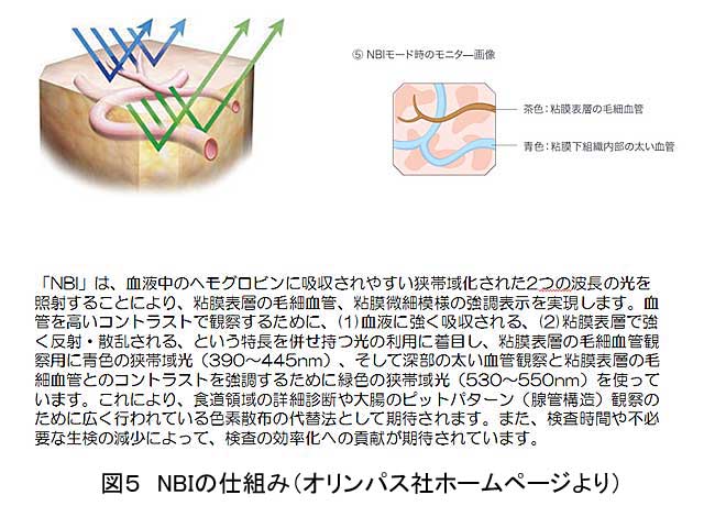 図5：NBIの仕組み（オリンパス社ホームページより）。NBIは血液中のヘモグロビンに吸収されやすい狭帯域化された2つの波長の光を照射することにより、粘膜表層の毛細血管、粘膜微細模様の強調表示を実現します。血管を高いコントラストで観察するために、（1）血液に強く吸収される、（2）粘膜表層で強く反射、散乱される、という特長を併せ持つ光の利用に着目し、粘膜表層の毛細血管観察用に青色の狭帯域光（390～445nm）、そして深部の太い血管観察と粘膜表層の毛細血管とのコントラストを強調するために緑色の狭帯域光（530～550nm）を使っています。これにより、食道領域の詳細診断や大腸のピットパターン（腺管構造）観察のために広く行われている色素散布の代替法として期待されます。また、検査時間や不必要な生検の減少によって、検査の効率化への貢献が期待されています。