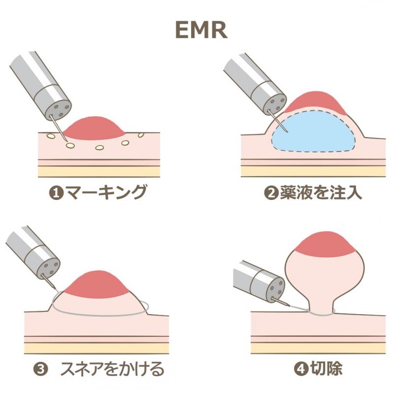 emr