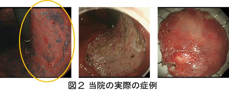 図2当院の実際の症例の写真