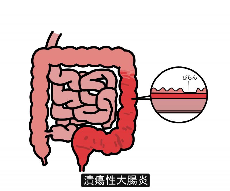 UC