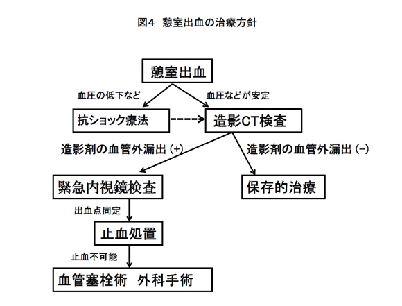 図4：憩室出血の治療方針。憩室出血があった場合、血圧などが安定していれば造影CT検査を行います。血圧の低下などがみられた場合は抗ショック療法後に造影CT検査を行います。造影CT検査で造影剤の血管外漏出が見られなかった場合は保存的治療を行い、造影剤の血管外漏出が見られた場合は、緊急内視鏡検査行い、出血点同定後、止血処置を行います。止血不可能でしたら、血管塞栓術外科手術を行います。